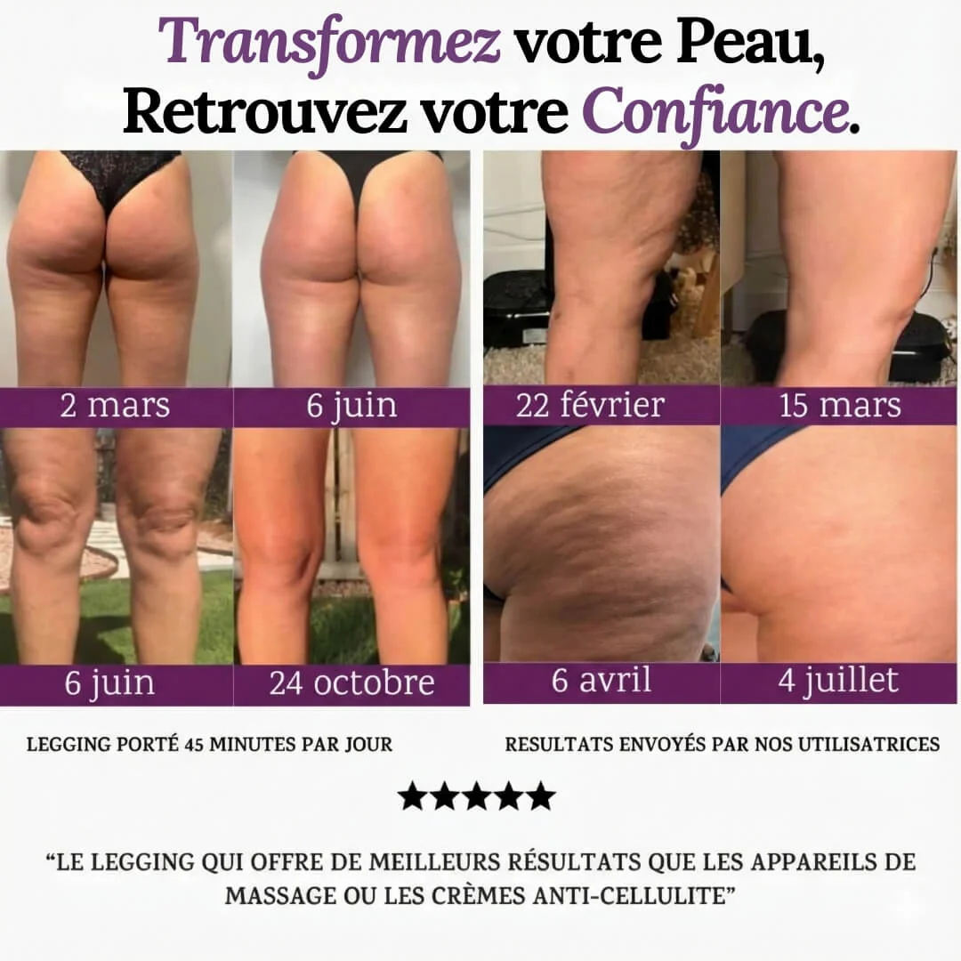 Legging Sculptant 3D - Anti-Cellulite - Image 4